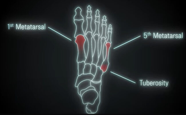 Foot diagram
